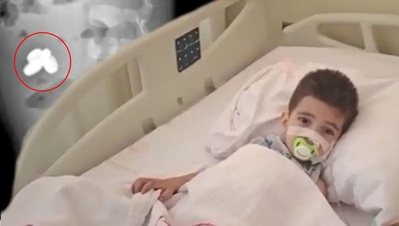 Pil ve Mıknatıs Yutan Çocuğun Sağlığı Tehlikeye Girdi: Aileler Dikkat!